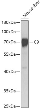 Western blot - C9 Polyclonal Antibody 