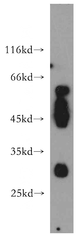 HL-60 cells were subjected to SDS PAGE followed by western blot with Catalog No:111883(AMICA1 antibody) at dilution of 1:800