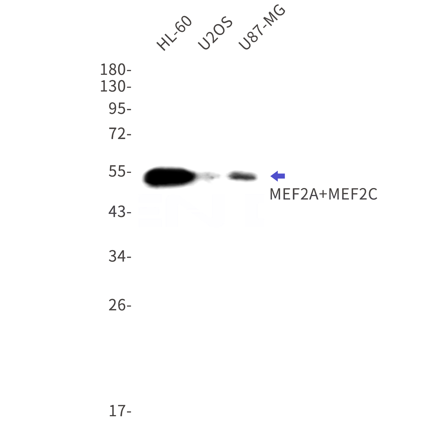 Western blot detection of MEF2A+MEF2C in HL-60,U2OS,U87-MG cell lysates using MEF2A+MEF2C Rabbit mAb(1:1000 diluted).Observed band size:51kDa.