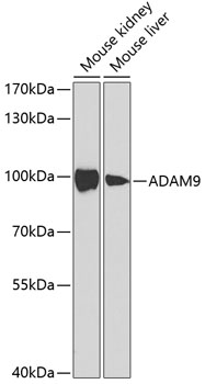 Western blot - ADAM9 Polyclonal Antibody 