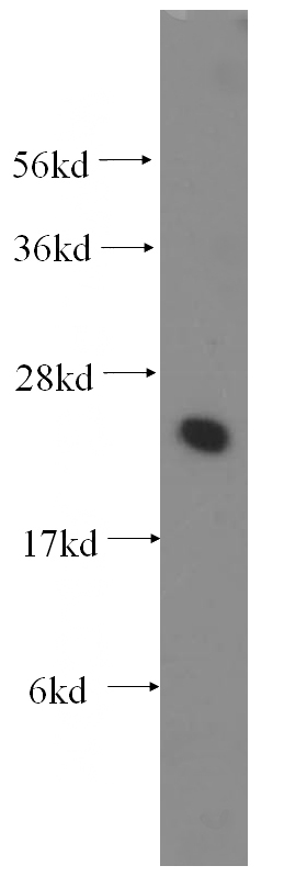 human brain tissue were subjected to SDS PAGE followed by western blot with Catalog No:116529(UBE2K antibody) at dilution of 1:400