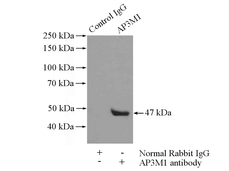 IP Result of anti-AP3M1 (IP:Catalog No:108124, 4ug; Detection:Catalog No:108124 1:300) with NIH/3T3 cells lysate 1200ug.