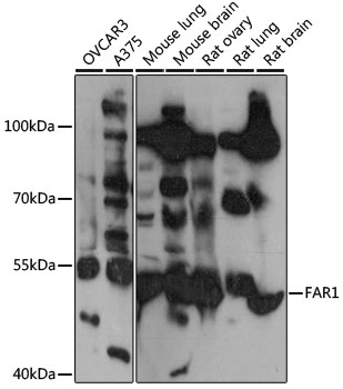 Western blot - FAR1 Polyclonal Antibody 