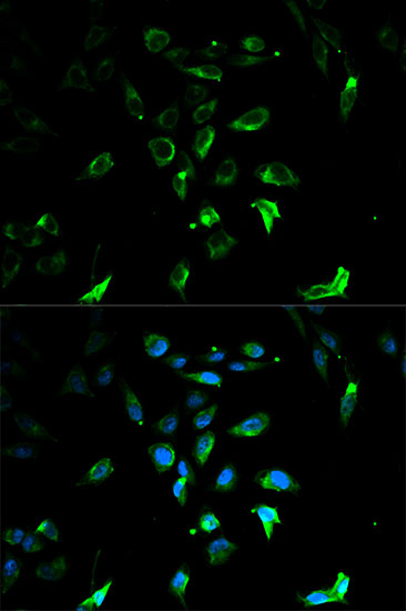 Immunofluorescence - STAR Polyclonal Antibody 