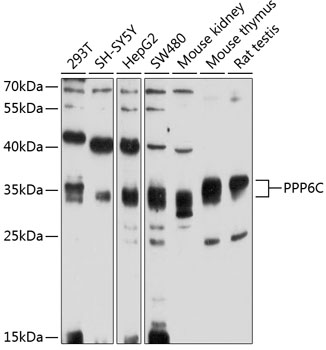 Western blot - PPP6C Polyclonal Antibody 