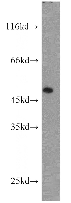 HeLa cells were subjected to SDS PAGE followed by western blot with Catalog No:111798(INHBA antibody) at dilution of 1:1000