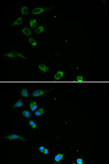 Immunofluorescence - HFE Polyclonal Antibody 