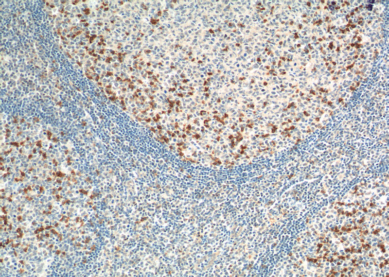 Immunohistochemistry of paraffin-embedded human tonsillitis tissue slide using Catalog No:113761(PD-1/CD279 Antibody) at dilution of 1:200 (under 10x lens). heat mediated antigen retrieved with Tris-EDTA buffer(pH9).