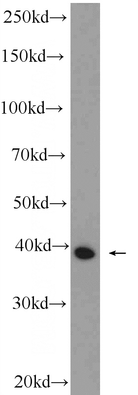 mouse skeletal muscle tissue were subjected to SDS PAGE followed by western blot with Catalog No:116272(TMOD4 Antibody) at dilution of 1:600