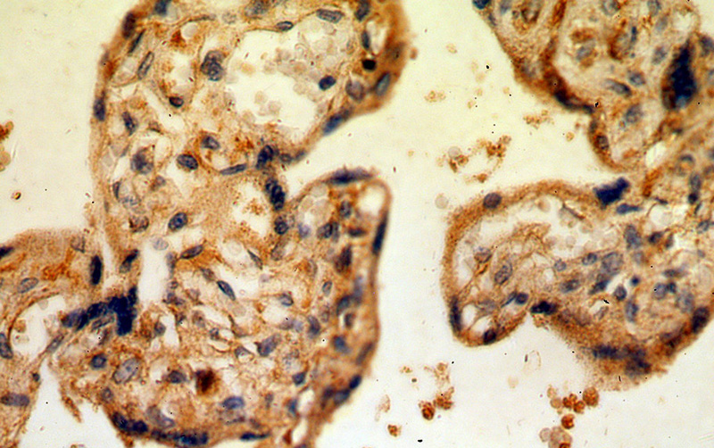 Immunohistochemical of paraffin-embedded human placenta using Catalog No:109594(CSF2RA antibody) at dilution of 1:50 (under 40x lens)