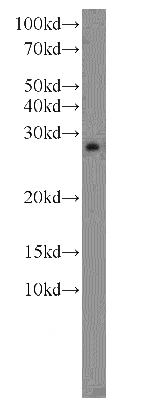 SKOV-3 cells were subjected to SDS PAGE followed by western blot with Catalog No:110313(EEF1B2 antibody) at dilution of 1:1000
