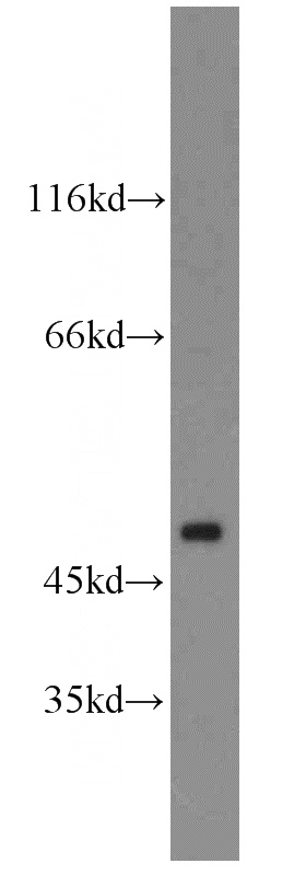 SH-SY5Y cells were subjected to SDS PAGE followed by western blot with Catalog No:108238(ARC antibody) at dilution of 1:500