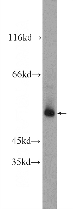 human testis tissue were subjected to SDS PAGE followed by western blot with Catalog No:114066(POTEA Antibody) at dilution of 1:300