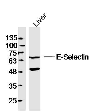 Fig2: Sample: Liver (Mouse) Lysate at 40 ug; Primary: Anti- E-Selectin at 1/300 dilution; Secondary: IRDye800CW Goat Anti-Rabbit IgG at 1/20000 dilution; Predicted band size: 65 kD; Observed band size: 65 kD