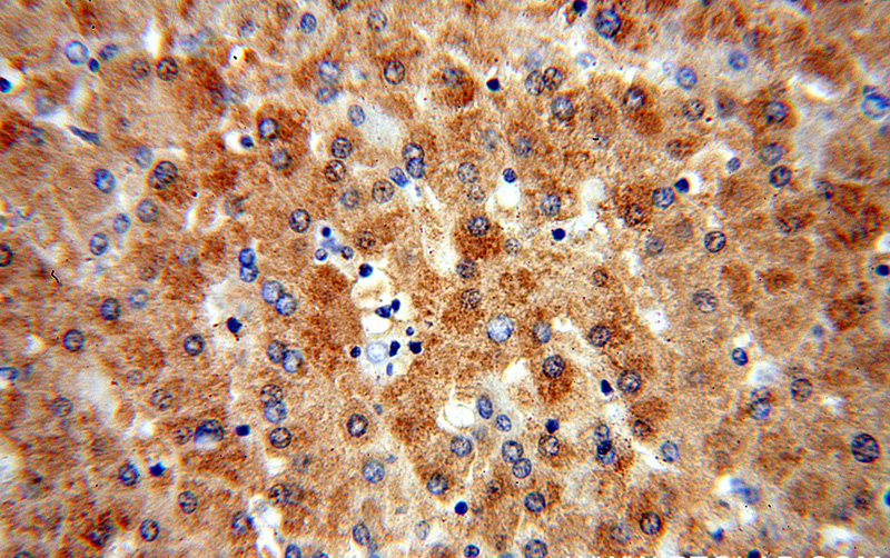 Immunohistochemical of paraffin-embedded human liver using Catalog No:113335(OGG1 antibody) at dilution of 1:100 (under 40x lens)