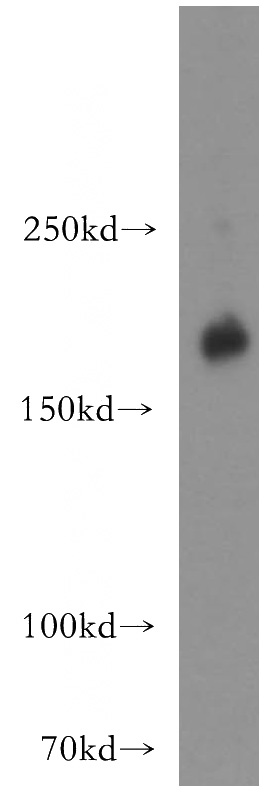 HeLa cells were subjected to SDS PAGE followed by western blot with Catalog No:111294(ERBB2 antibody) at dilution of 1:300