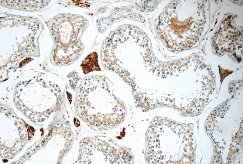 Immunohistochemistry of paraffin-embedded human testis tissue slide using Catalog No:109231(CHMP1A Antibody) at dilution of 1:50 (under 10x lens)