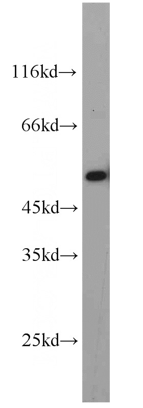A549 cells were subjected to SDS PAGE followed by western blot with Catalog No:112392(MAGED4 antibody) at dilution of 1:1000