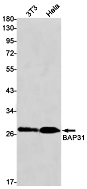 Western blot detection of BAP31 in K562,Hela cell lysates using BAP31 Rabbit mAb(1:1000 diluted).Predicted band size:28kDa.Observed band size:28kDa.