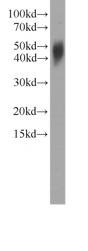 human brain tissue were subjected to SDS PAGE followed by western blot with Catalog No:107385(IL17F antibody) at dilution of 1:1000