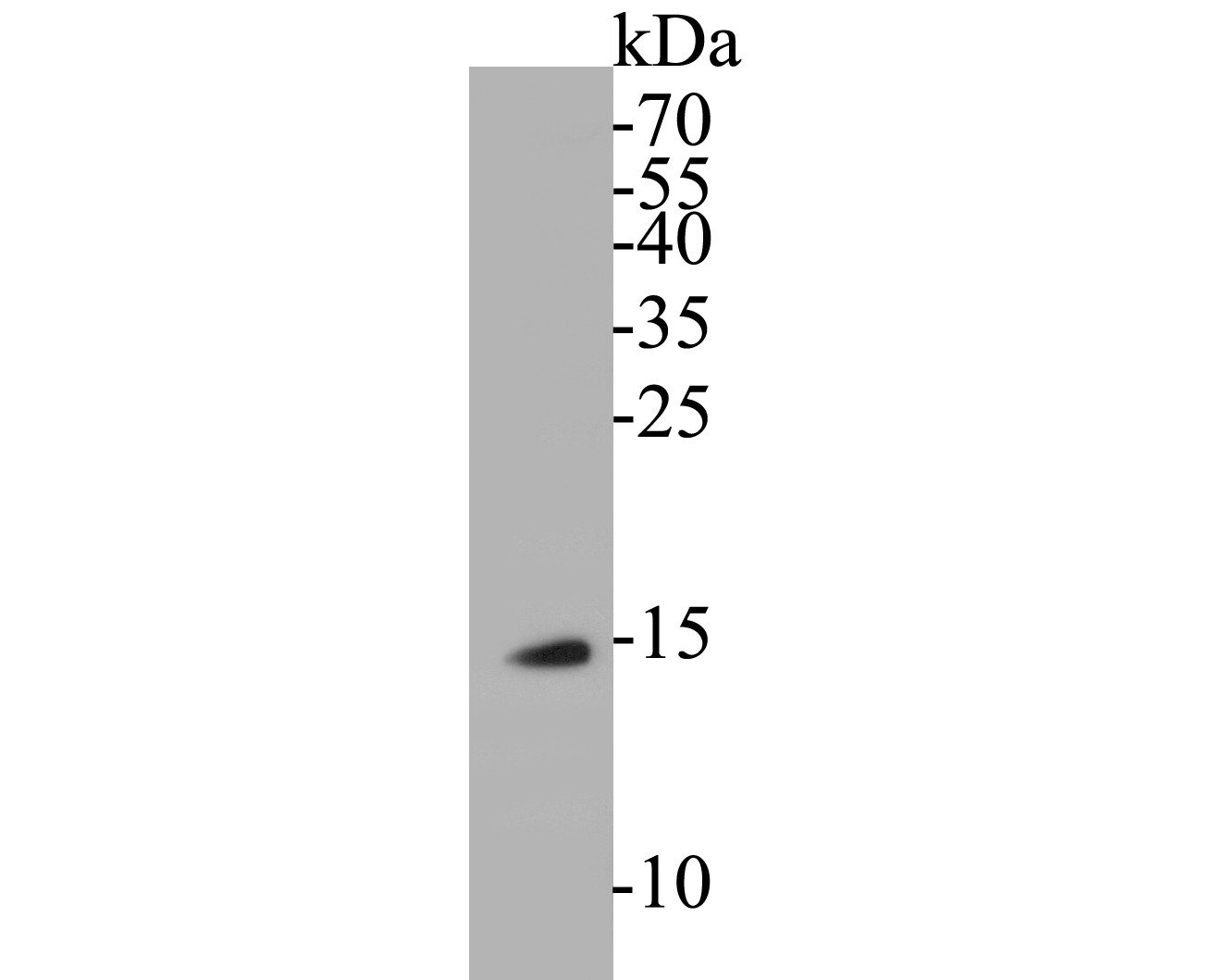 Fig1: Western blot analysis of BLOS1 on rice tissue lysates. Proteins were transferred to a PVDF membrane and blocked with 5% BSA in PBS for 1 hour at room temperature. The primary antibody ( 1/500) was used in 5% BSA at room temperature for 2 hours. Goat Anti-Rabbit IgG - HRP Secondary Antibody (HA1001) at 1:5,000 dilution was used for 1 hour at room temperature.