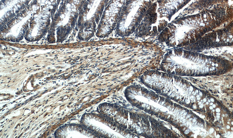 Immunohistochemistry of paraffin-embedded human colon slide using Catalog No:114217(PHB2 Antibody) at dilution of 1:50