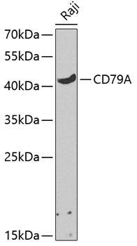 Western blot - CD79A Polyclonal Antibody 