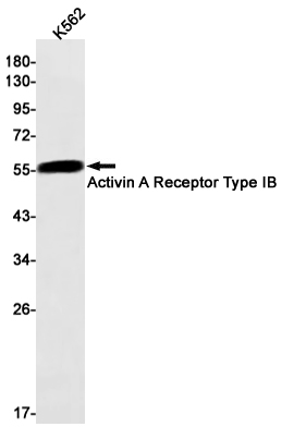 Western blot detection of Activin A Receptor Type IB in K562 cell lysates using Activin A Receptor Type IB Rabbit mAb(1:1000 diluted).Predicted band size:57kDa.Observed band size:57kDa.