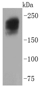 Fig1:; Western blot analysis of Dysferlin on skeletal muscle tissue lysates. Proteins were transferred to a PVDF membrane and blocked with 5% BSA in PBS for 1 hour at room temperature. The primary antibody ( 1/500) was used in 5% BSA at room temperature for 2 hours. Goat Anti-Rabbit IgG - HRP Secondary Antibody (HA1001) at 1:40,000 dilution was used for 1 hour at room temperature.