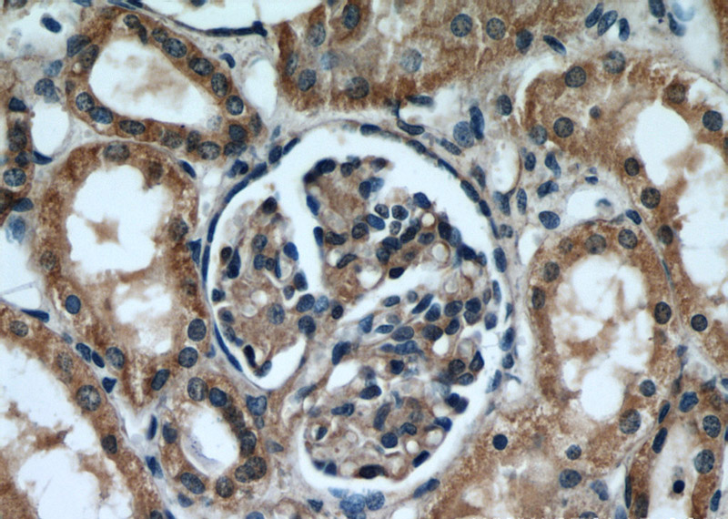Immunohistochemical of paraffin-embedded human kidney using Catalog No:111847(INSC antibody) at dilution of 1:50 (under 40x lens)
