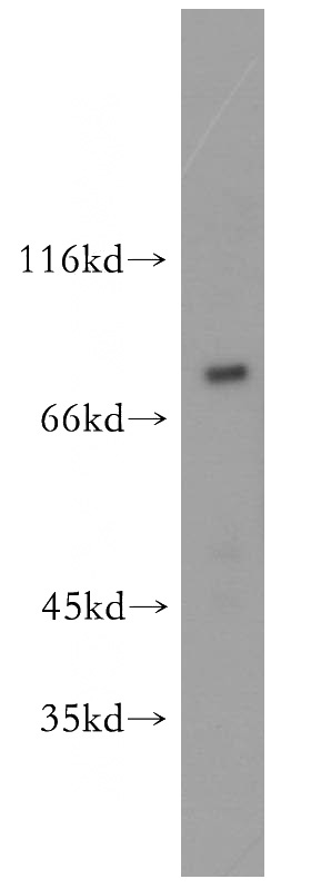 mouse kidney tissue were subjected to SDS PAGE followed by western blot with Catalog No:113176(NHE8 antibody) at dilution of 1:500