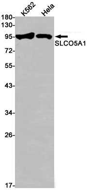 Western blot detection of SLCO5A1 in K562,Hela cell lysates using SLCO5A1 Rabbit pAb(1:1000 diluted).Predicted band size:92kDa.Observed band size:92kDa.
