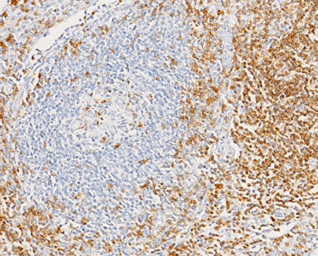 CD7 / LEU9 Antibody, Rabbit MAb, Immunohistochemistry
