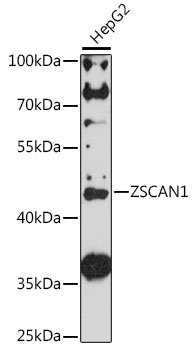 Western blot - ZSCAN1 Polyclonal Antibody 