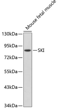 Western blot - SKI Polyclonal Antibody 