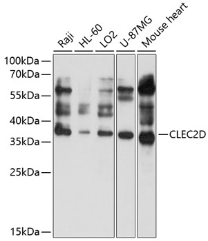 Western blot - CLEC2D Polyclonal Antibody 