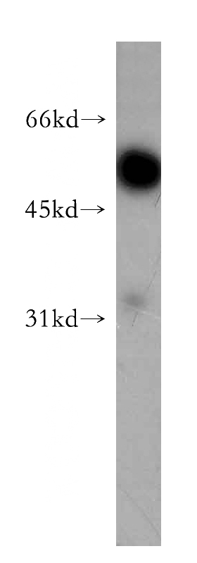 human brain tissue were subjected to SDS PAGE followed by western blot with Catalog No:115778(SYT9 antibody) at dilution of 1:500