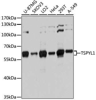 Western blot - TSPYL1 Polyclonal Antibody 
