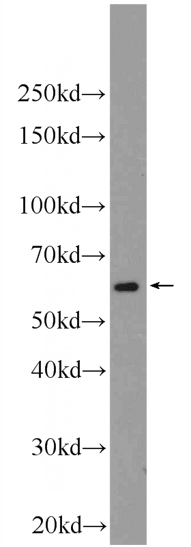 Jurkat cells were subjected to SDS PAGE followed by western blot with Catalog No:111456(HPSE Antibody) at dilution of 1:1000