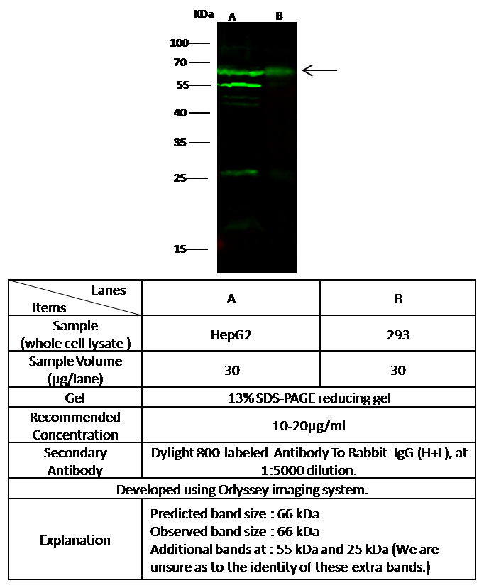 Glypican 3 / GPC3 / OCI-5 Antibody, Rabbit PAb, Antigen Affinity Purified, Western blot