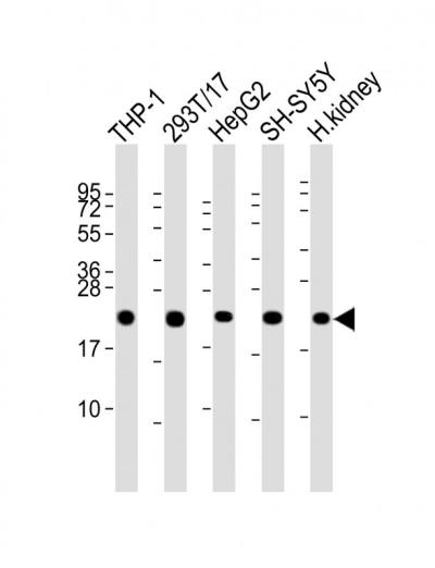 All lanes: Anti-GPX1 Antibody (C-term) at 1:2000 dilutionnLane 1: THP-1 whole cell lysatenLane 2: 293T/17 whole cell lysatenLane 3: HepG2 whole cell lysatenLane 4: SH-SY5Y whole cell lysatenLane 5: human kidney lysatennLysates/proteins at 20 u03bcg per lane. nnSecondarynGoat Anti-Rabbit IgG,  (H+L), Peroxidase conjugated at 1/10000 dilution. nnPredicted band size: 22 kDannBlocking/Dilution buffer: 5% NFDM/TBST.