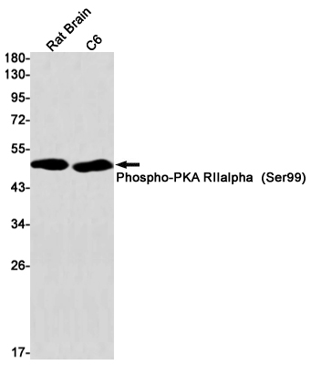 Western blot detection of Phospho-PKA RIIalpha  (Ser99) in Rat Brain,C6 cell lysates using Phospho-PKA RIIalpha  (Ser99) Rabbit mAb(1:1000 diluted).Predicted band size:46kDa.Observed band size:50kDa.