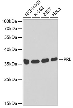 Western blot - PRL Polyclonal Antibody 