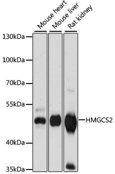 Western blot - HMGCS2 Polyclonal Antibody 