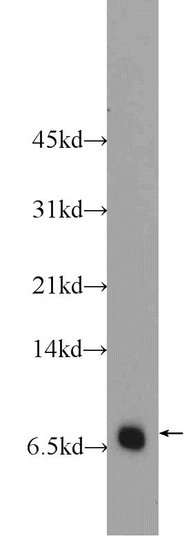 HL-60 cells were subjected to SDS PAGE followed by western blot with Catalog No:114896(RPL39L Antibody) at dilution of 1:600