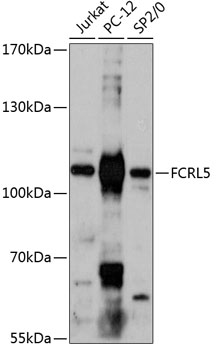 Western blot - FCRL5 Polyclonal Antibody 