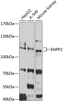 Western blot - ENPP2 Polyclonal Antibody 