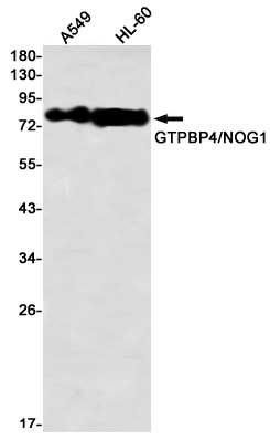 Western blot detection of GTPBP4/NOG1 in A549,HL-60 using GTPBP4/NOG1 Rabbit mAb(1:1000 diluted)