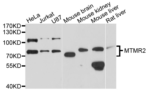 Western blot - MTMR2 Polyclonal Antibody 