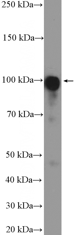 Jurkat cells were subjected to SDS PAGE followed by western blot with Catalog No:112296(LONP2 Antibody) at dilution of 1:600